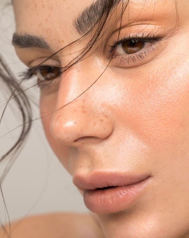 Close-up of a woman's face showing natural lip and cheek enhancement with facial fillers.